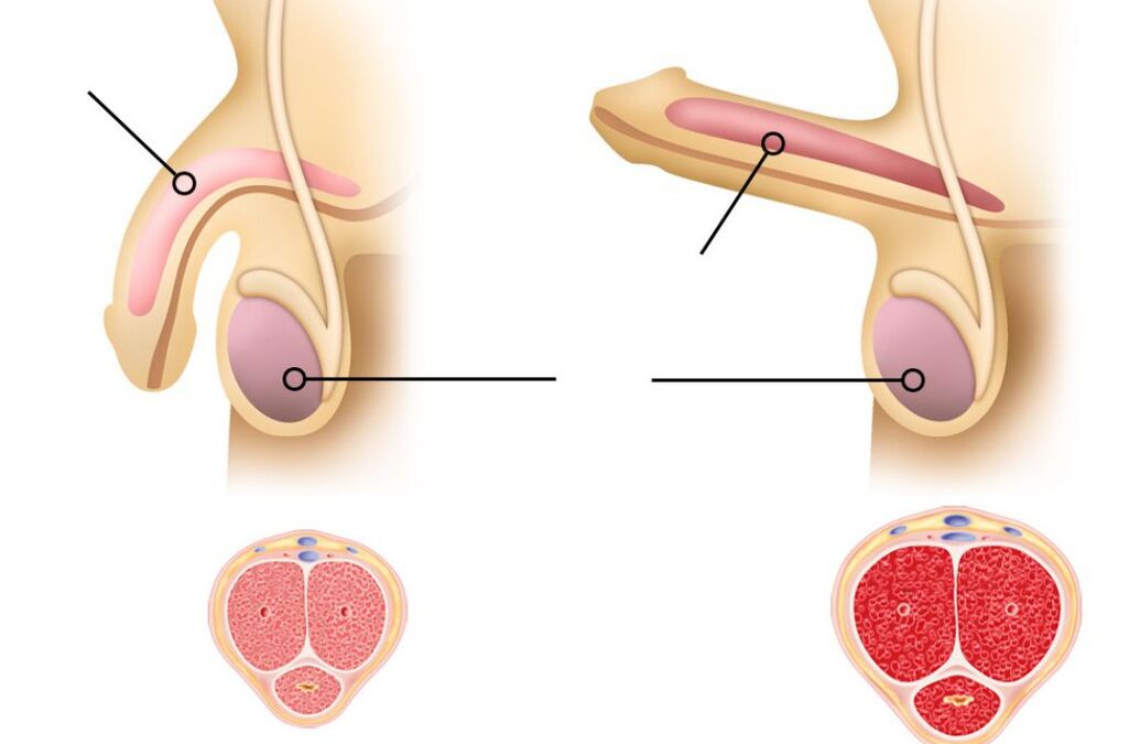 Reasons for decreased potency in men